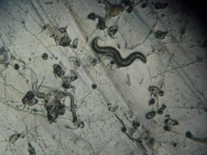 microscope worm